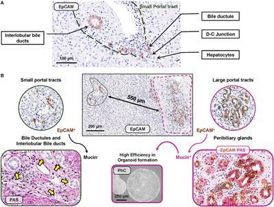 Distinct EpCAM-Positive Stem Cell Niches Are Engaged in Chronic and Neoplastic Liver Diseases